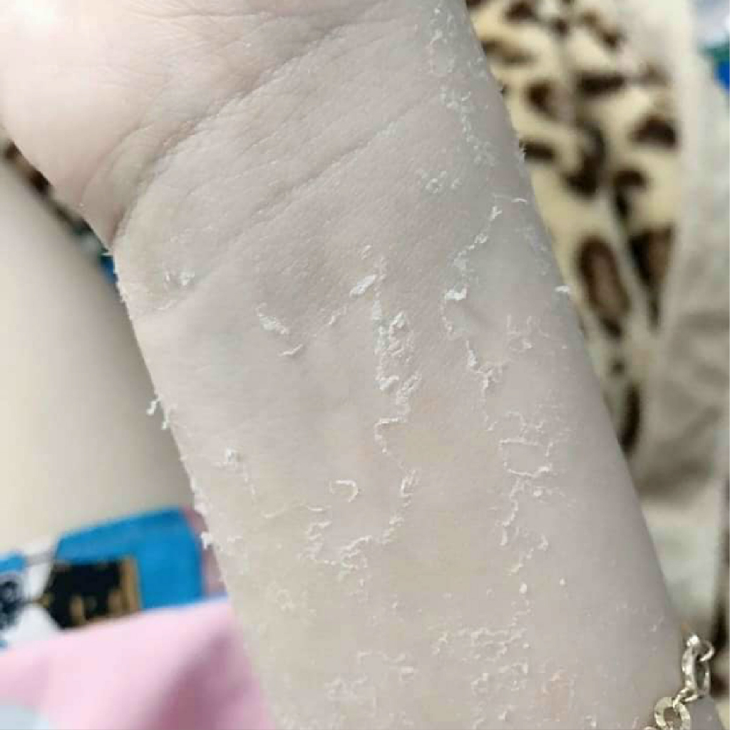 Body bong da - Body peel da - Body bong tái tạo da Handmade 200gr - Đánh bay mọi làn da đen sạm