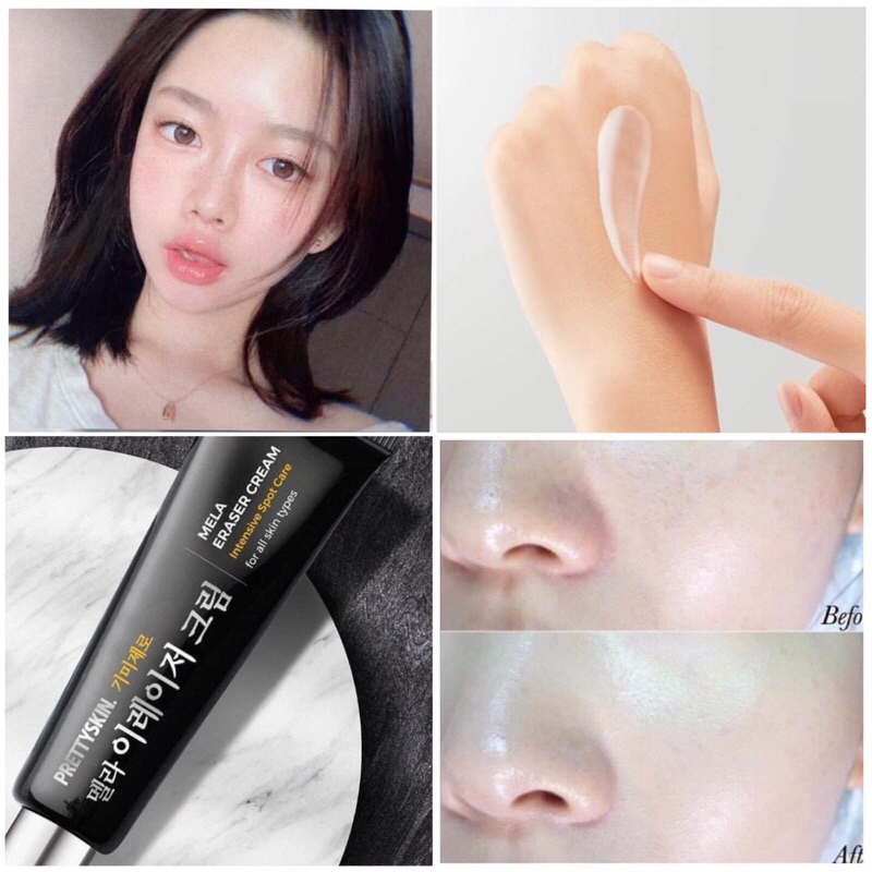 Kem Hủy Sắc Tố Nám, Kem Trắng Da Chuyên Bán Hiệu Thuốc Lớn Tại Hàn Giảm Sạm Nám Tàn Nhang Kiềm Dầu Cân Bằng Độ Ẩm