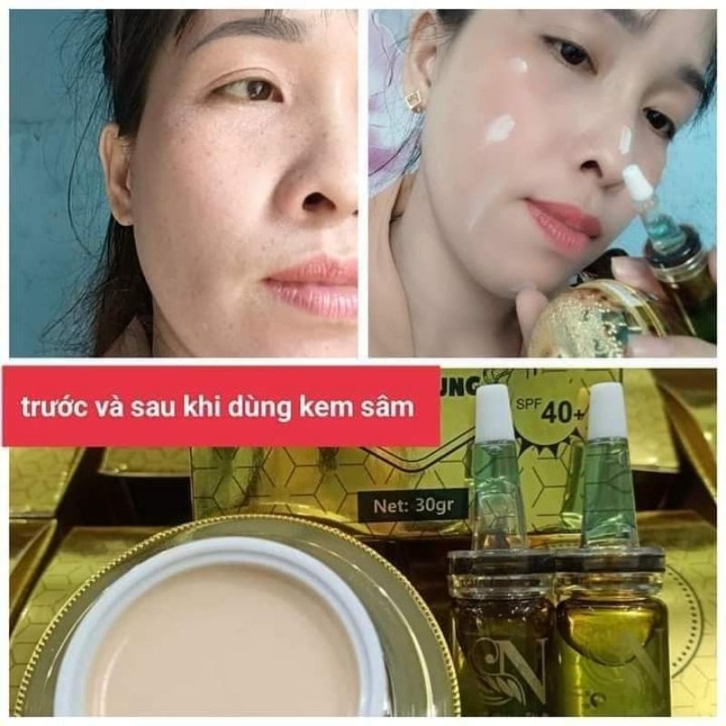 KEM SÂM NHUNG TƯƠI TẶNG KÈM 2 CHAI SERUM GIẢM NÁM, TÀN NHANG, NGĂN NGỪA LÃO HÓA DA