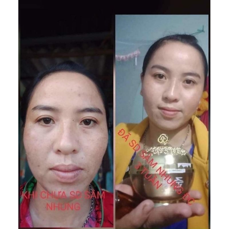 KEM SÂM NHUNG TƯƠI TẶNG KÈM 2 CHAI SERUM GIẢM NÁM, TÀN NHANG, NGĂN NGỪA LÃO HÓA DA