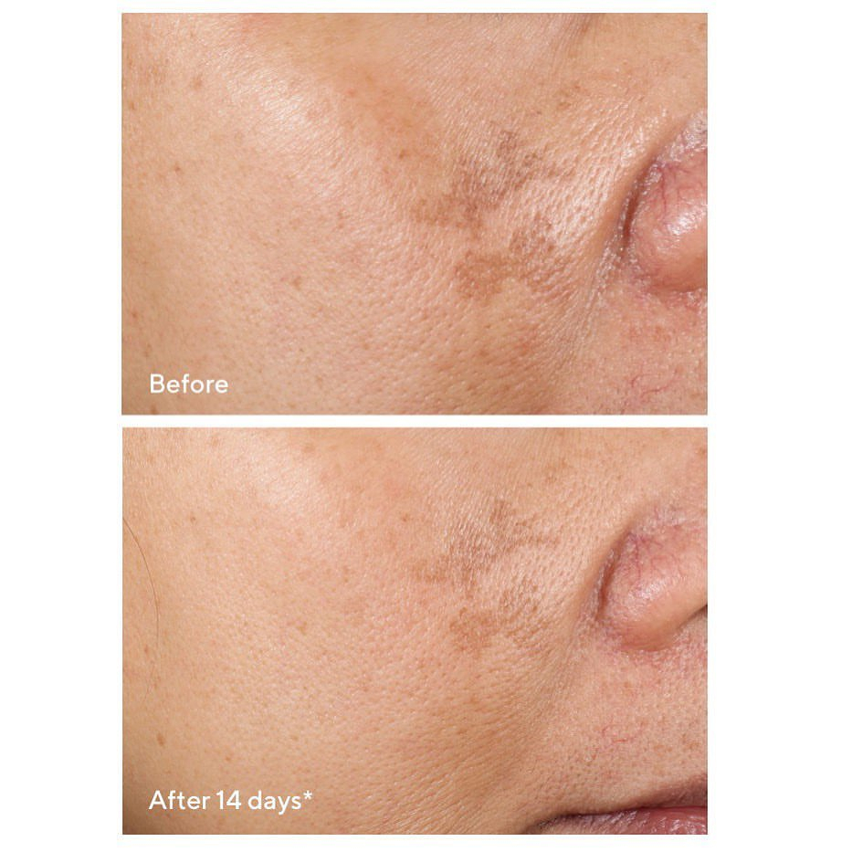 MURAD - Tinh Chất Giảm Thâm Nám, Đốm Nâu và Thâm Mụn Nhanh Murad Rapid Dark Spot Correcting Serum 30ml