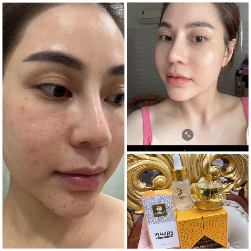 💥Combo kem face và serum B5 Gạo bamboo