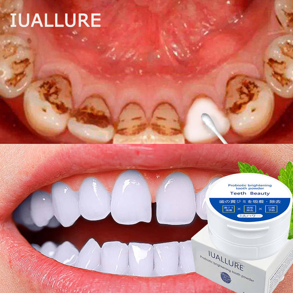 Kem đánh răng bột làm trắng răng 50g Làm trắng răng Loại bỏ vết ố và vàng răng Hơi thở thơm mát Chăm sóc răng miệng