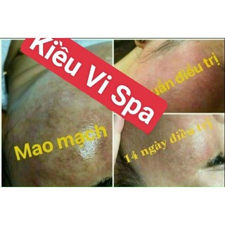 Serum giãn mao mạch