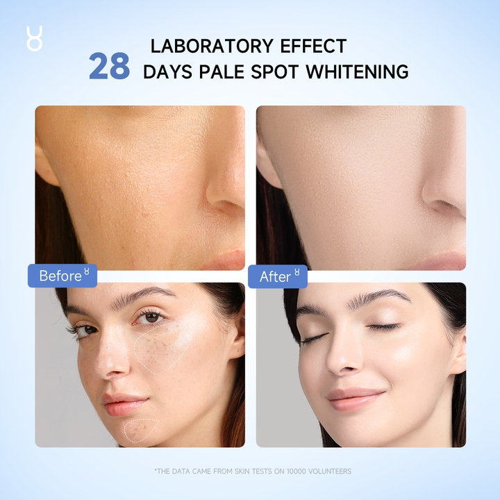 Serum Tinh Chất Sáng Da FOCALSKIN 3% NIACINAMIDE 3% ARBUTIN Làm Sáng Da Trong 7 Ngày 30ml