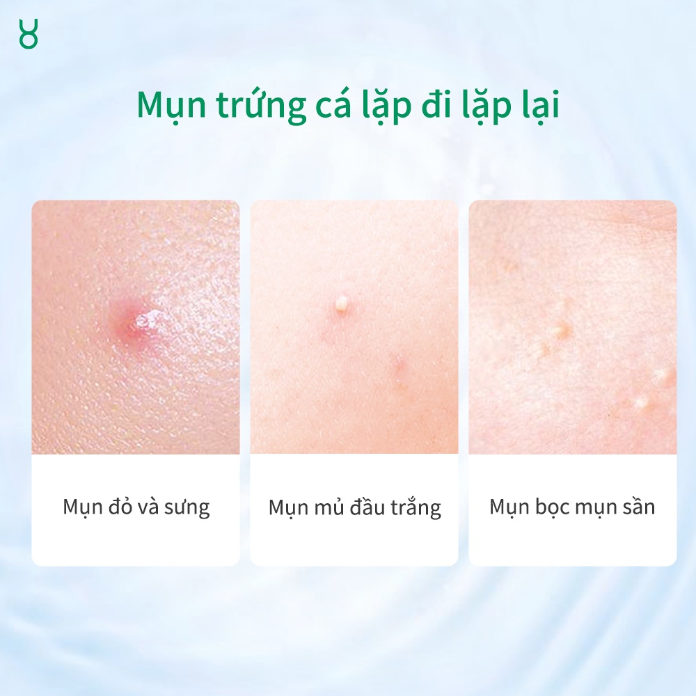 Tinh Chất Giảm Mụn FOCALSKIN Salicylic Acid Mờ Thâm Se Khít Lỗ Chân Lông 15g