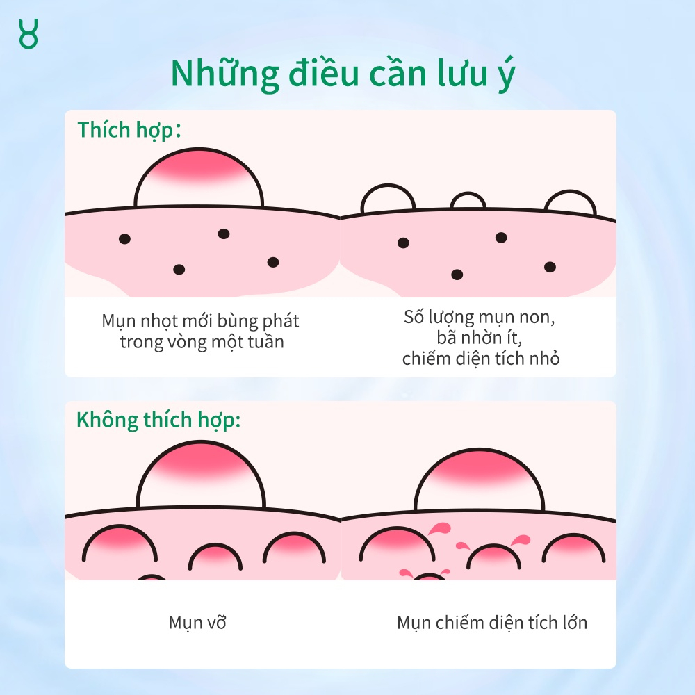 Tinh Chất Giảm Mụn FOCALSKIN Salicylic Acid Mờ Thâm Se Khít Lỗ Chân Lông 15g