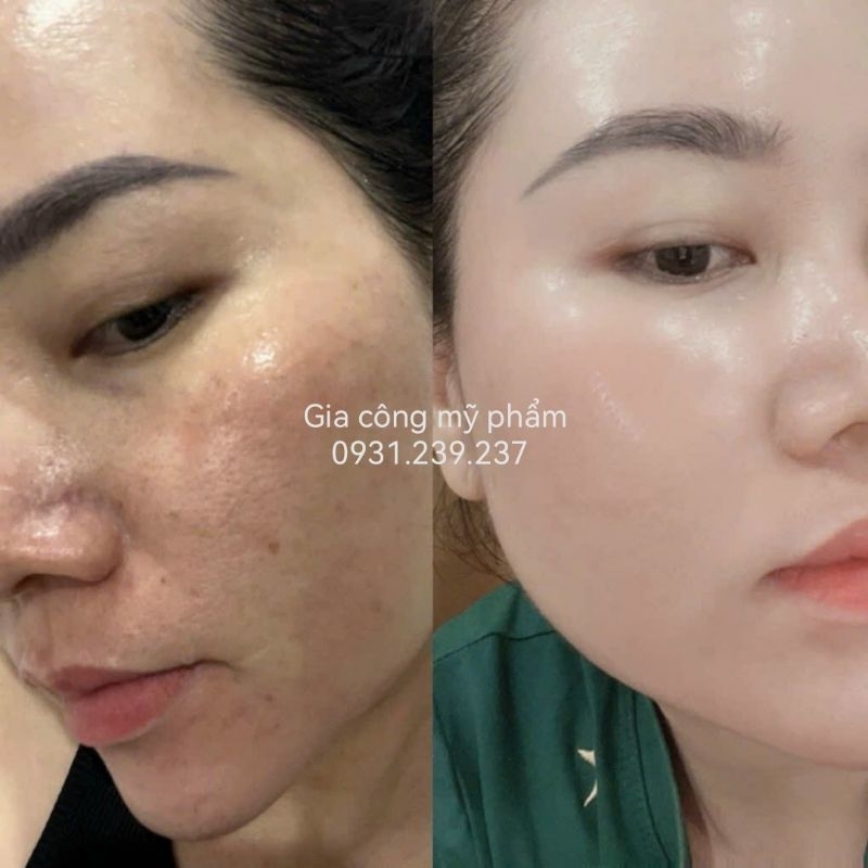 Kem  Nhung Hươu | Trắng Sáng Da | Giảm Thâm mụn | Mờ Nám Lâu Năm | Da Không Đều Màu..