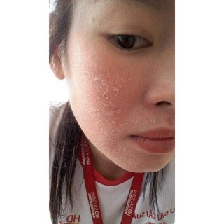 Cốt sâm đen tái tạo da