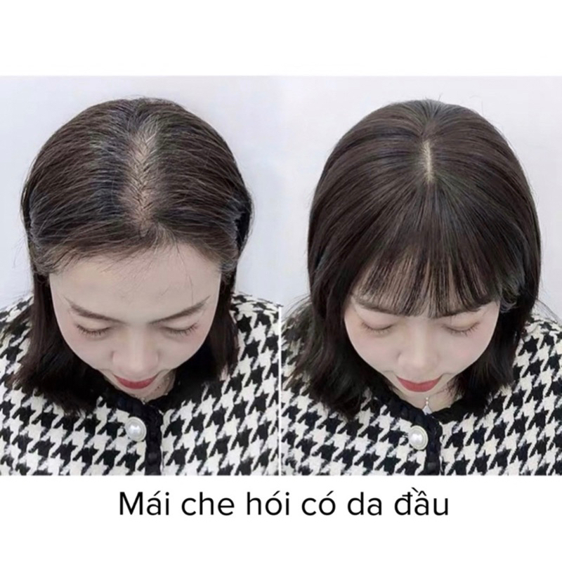 Che hói tóc thật 4D mini có mái