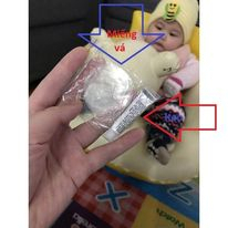 Bộ Keo vá bể bơi, phao bơi gồm 1 tuýp keo và 2 miếng vá trong suốt