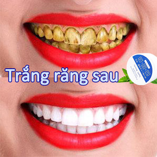 Bột tẩy trắng răng combo bột trắng răng tẩy mảng bám cao răng thơm miệng hết hôi miệng giảm sâu răng