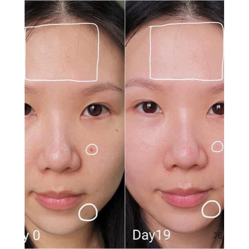 Tinh Chất Retinol Micro-Dose Giúp Da Tái Tạo, Căng Mướt & Sáng Khỏe dung tích