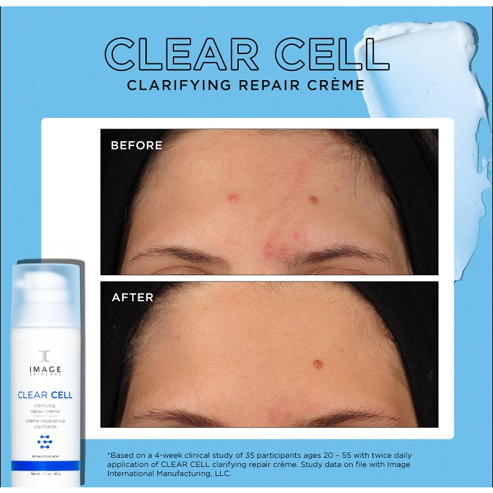 Kem dưỡng giảm mụn và kiểm soát dầu nhờn Image Skincare Clear Cell Clarifying Repair Creme 48g
