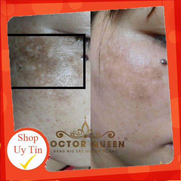 Kem nám DOCTOR QUEEN