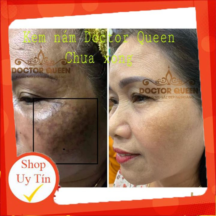 Kem nám DOCTOR QUEEN