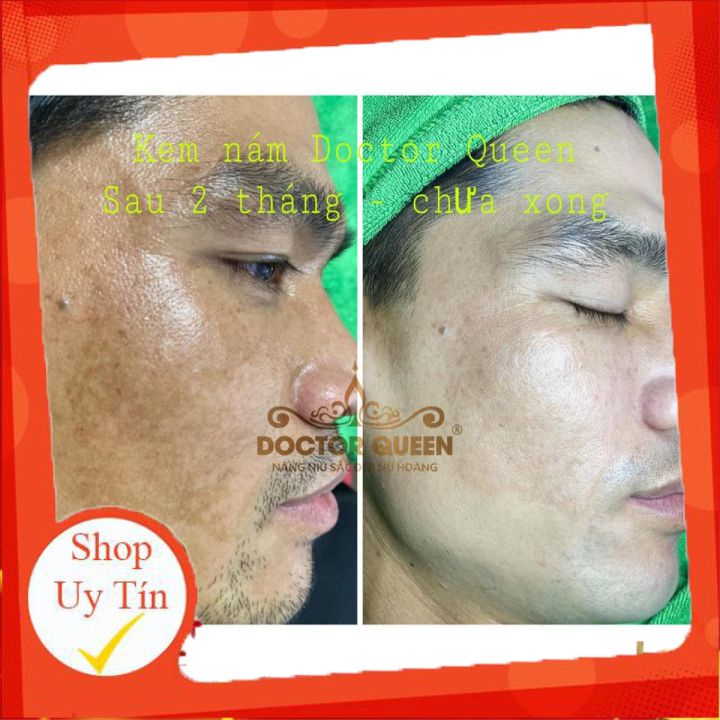 Kem nám DOCTOR QUEEN