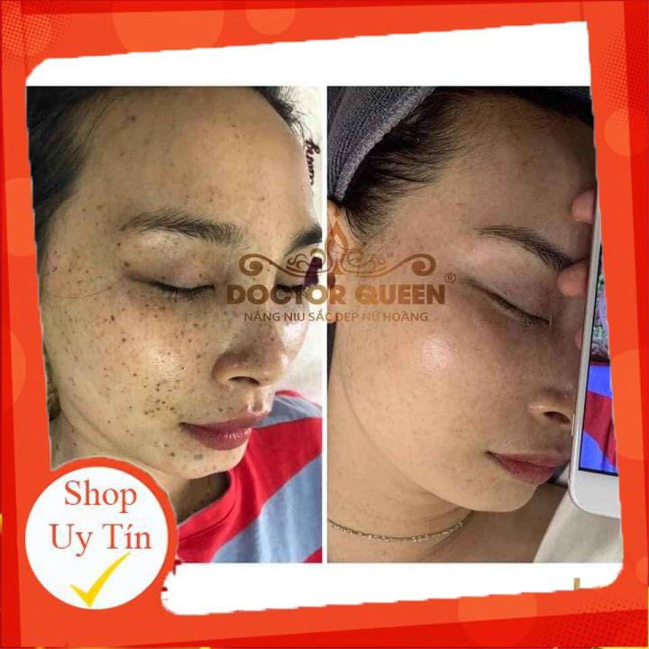 Kem nám DOCTOR QUEEN