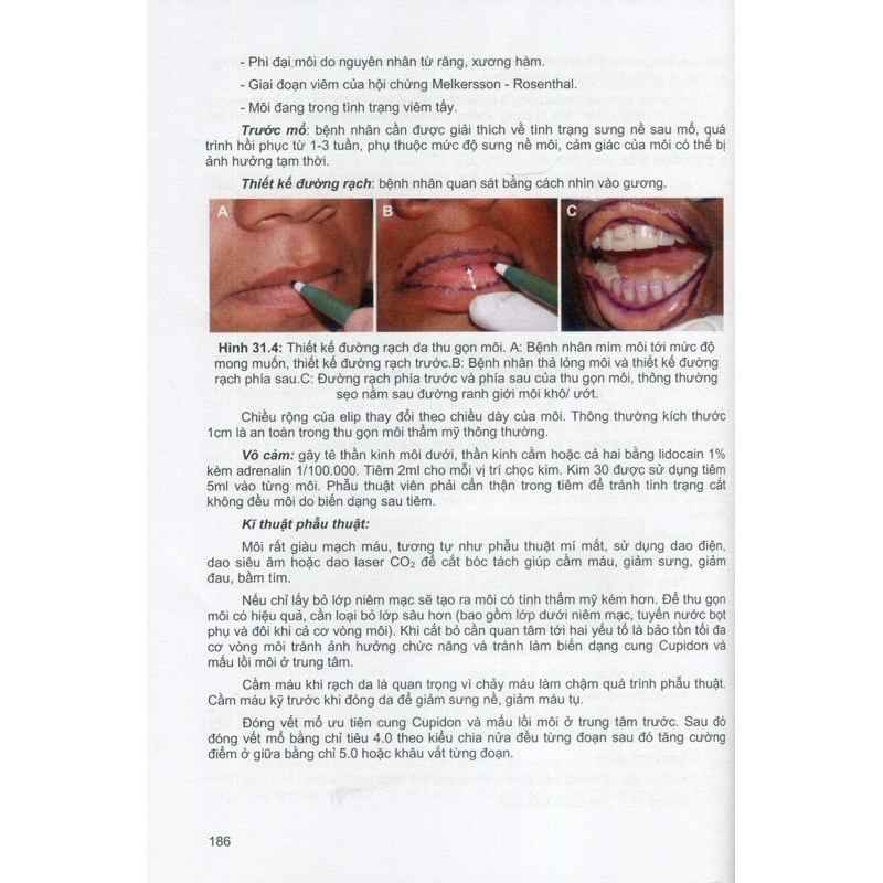 Sách - Bài giảng phẫu thuật tạo hình thẩm mỹ cơ bản 2023