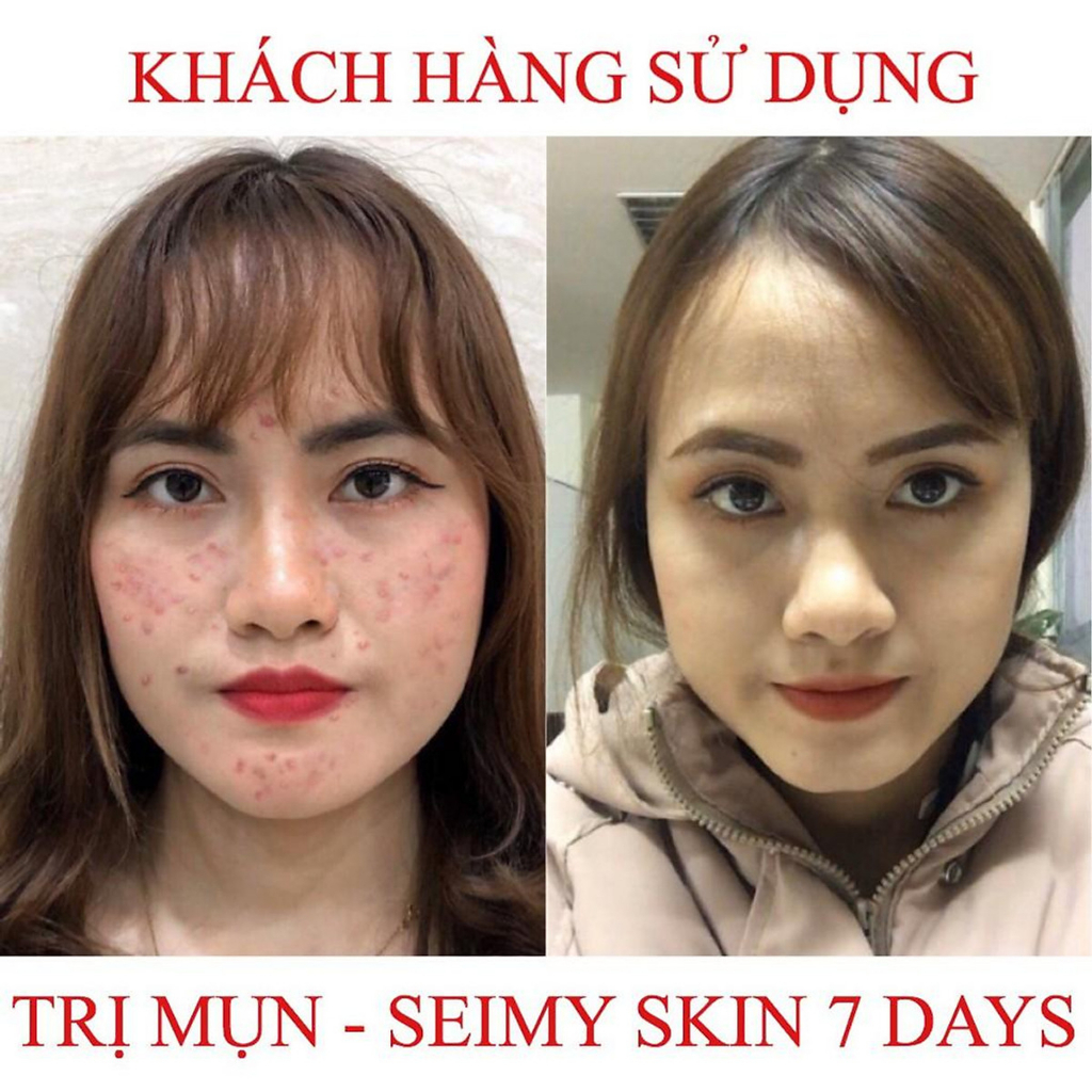 Serum Seimy 10ml giảm mụn thâm, sáng da, cấp ẩm, tái tạo da