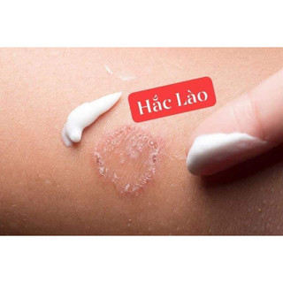 Tuýp bôi chống ngứa thảo mộc vàng phi tên lửa