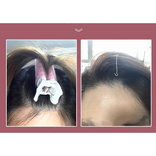 Lô kẹp phồng Tóc mái QiQiShop