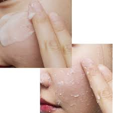 Tẩy da chết làm sáng da Dr.G Red Blemish peeling gel 150g tẩy tế bào chết Drg