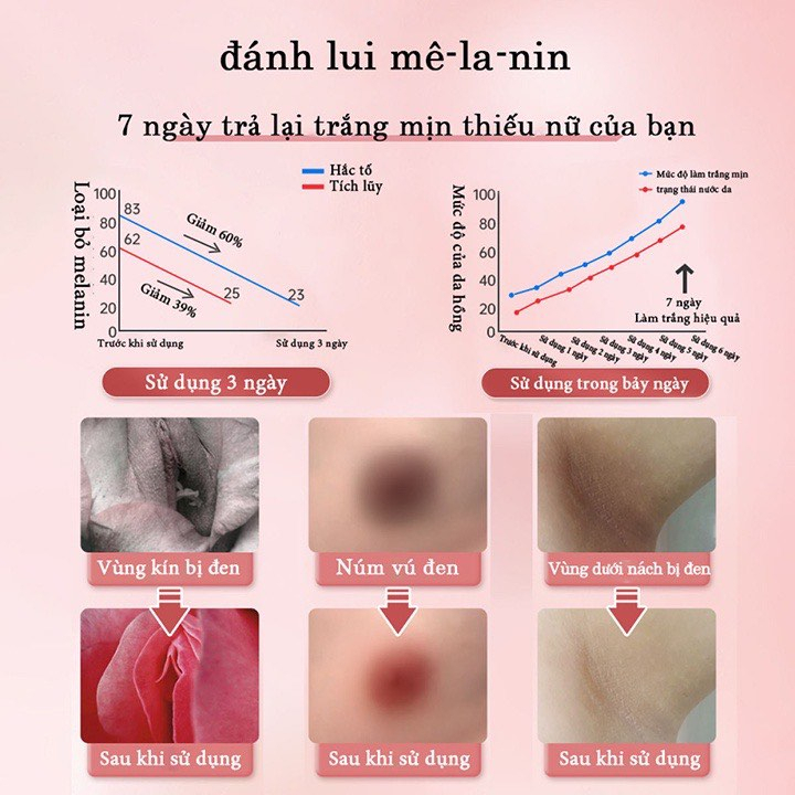 Kem Làm Hồng Nhũ Hoa Tại Nhà Nipple Pink 15ml, Dưỡng Hồng Khử Thâm Ti Vùng Kín