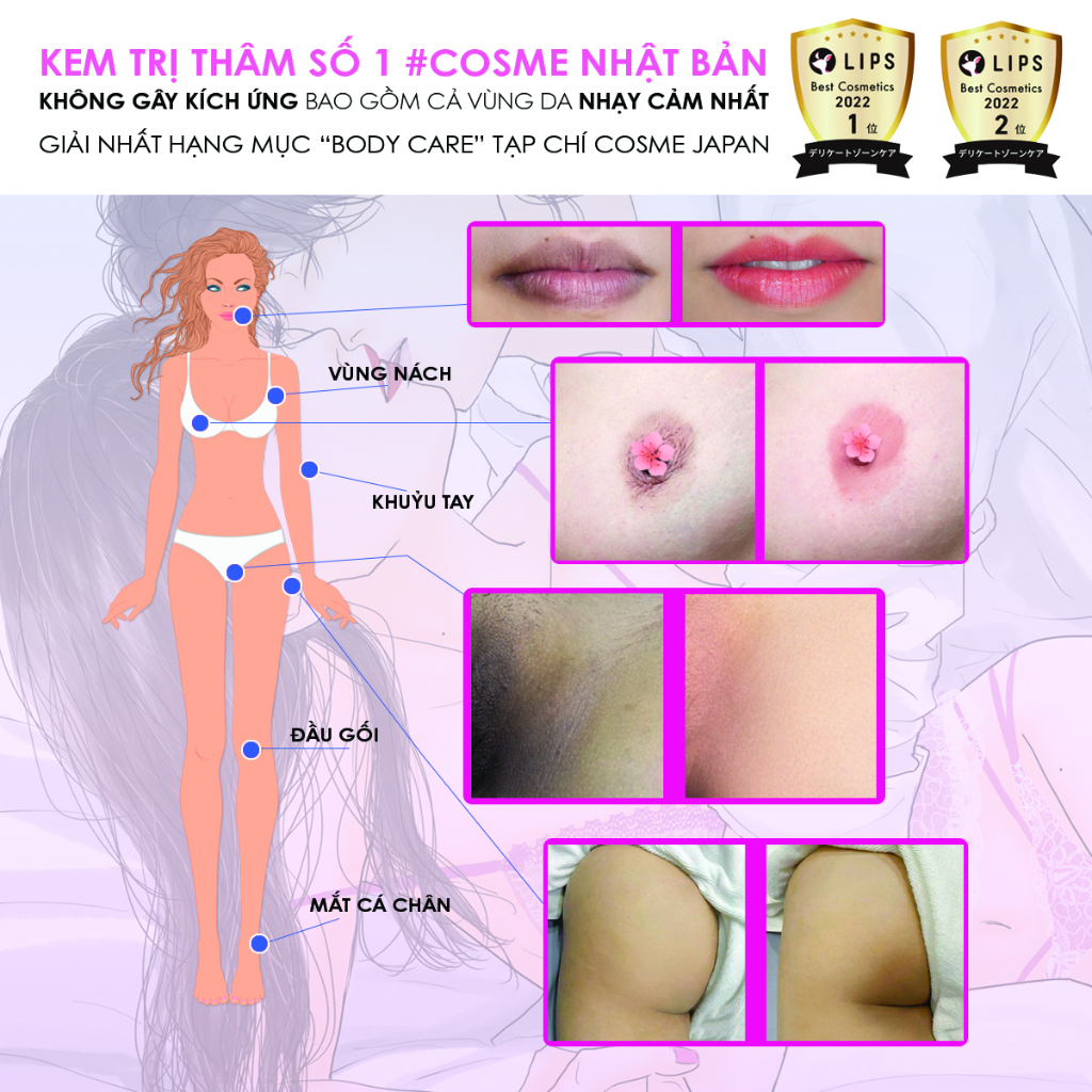 Kem Làm Hồng Vùng Kín Maputi White Cream Giảm Thâm Nhũ Hoa, Thâm Nách, Thâm Mông 100ml