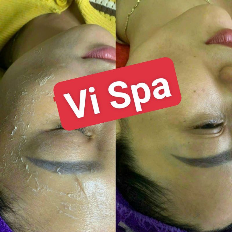 DR PEED VI TẢO BIỂN