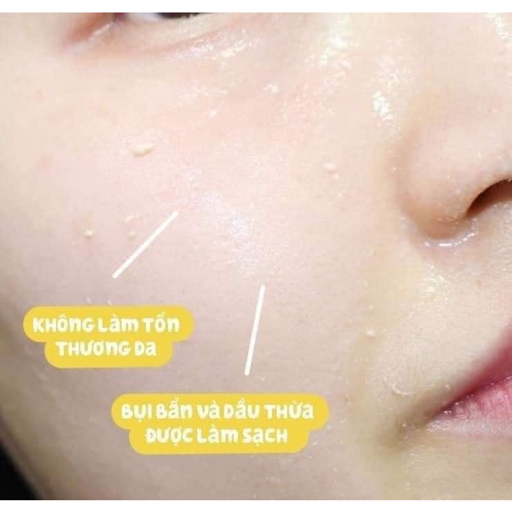 GEL TẨY DA CHẾT CARYOPHY 3IN1 - NGỪA MỤN