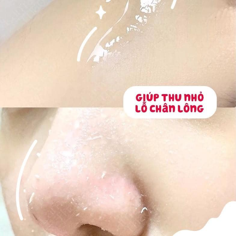 GEL TẨY DA CHẾT CARYOPHY 3IN1 - NGỪA MỤN