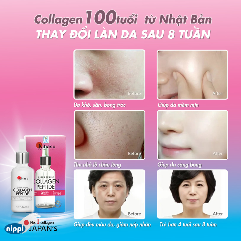 Serum Sáng da với serum collagen tươi KIHASU cao cấp từ Nhật Bản: chuyên sâu về da,ngăn ngừa lão hoá da, tăng đàn hồi da