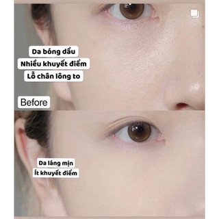 𝐏𝐇𝐀̂́𝐍 𝐍𝐔̛𝐎̛́𝐂 𝐈𝐍𝐍𝐈𝐒𝐅𝐑𝐄𝐄 𝐍𝐎 𝐒𝐄𝐁𝐔𝐌 𝐏𝐎𝐖𝐃𝐄𝐑 𝐂𝐔𝐒𝐇𝐈𝐎𝐍 𝐏𝐄𝐀𝐍𝐔𝐓𝐒