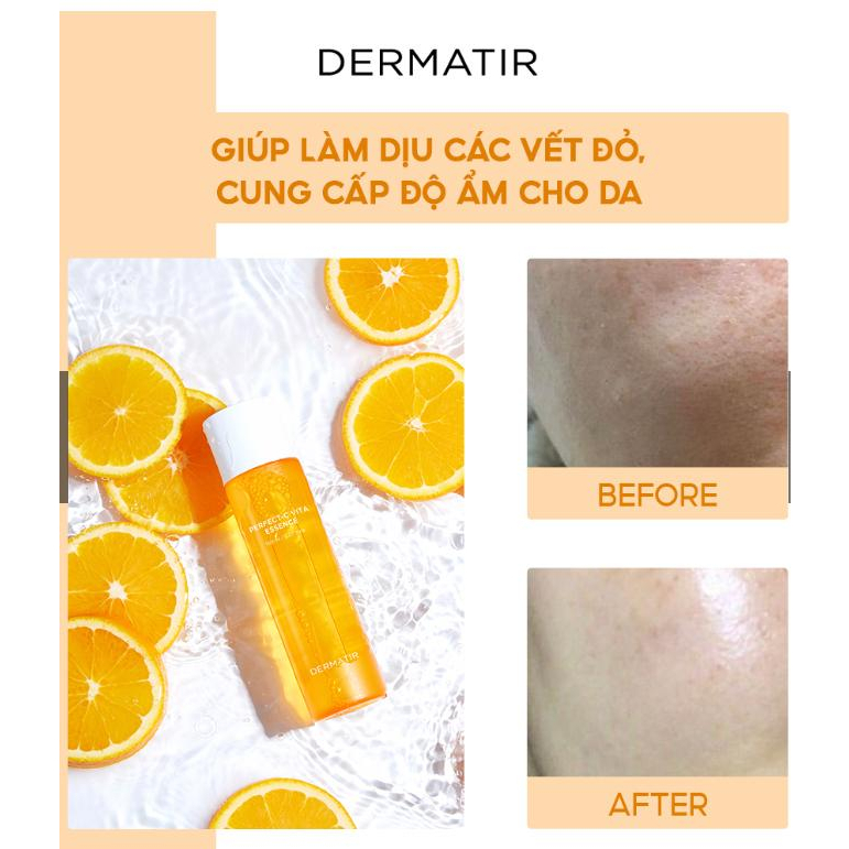 NƯỚC DƯỠNG DA DERMATIR Perfect-C Vita Essence 150ml