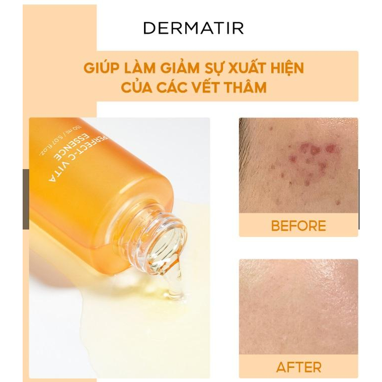 NƯỚC DƯỠNG DA DERMATIR Perfect-C Vita Essence 150ml