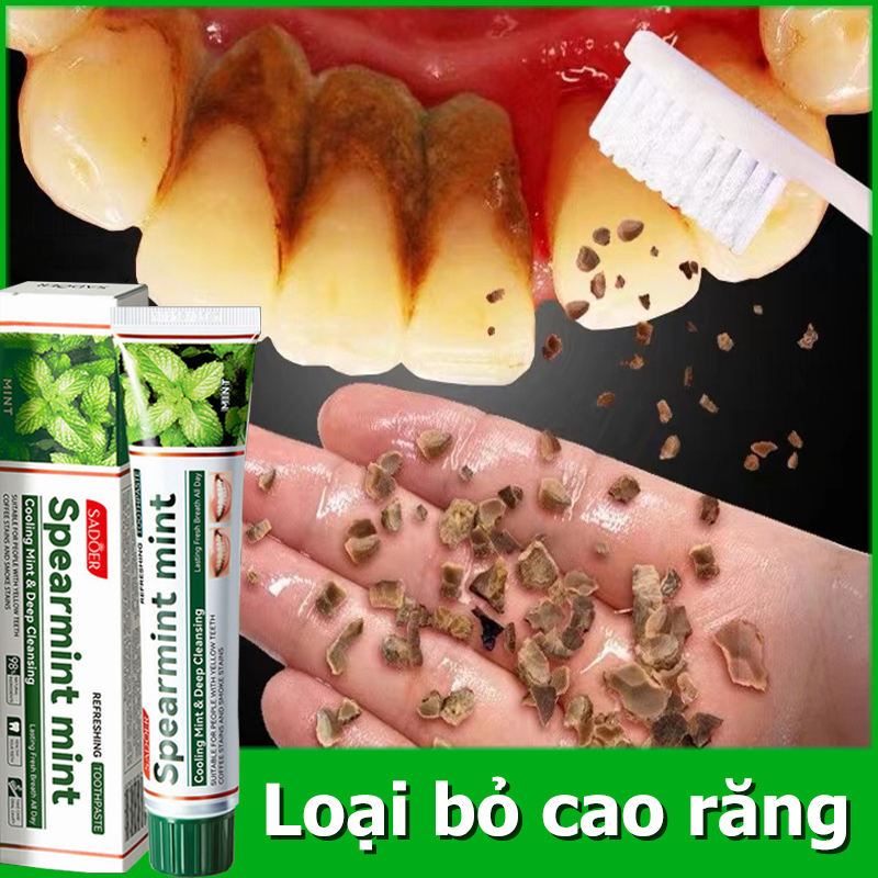 Kem Đánh Răng Làm Trắng Răng loại bỏ cao răng hôi miệng tẩy ố vàng 100g Sửa chữa nướu răng giảm sâu răng