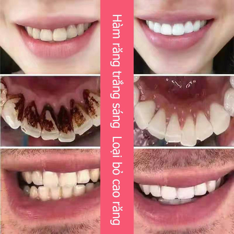 Kem Đánh Răng Làm Trắng Răng loại bỏ cao răng hôi miệng tẩy ố vàng 100g Sửa chữa nướu răng giảm sâu răng
