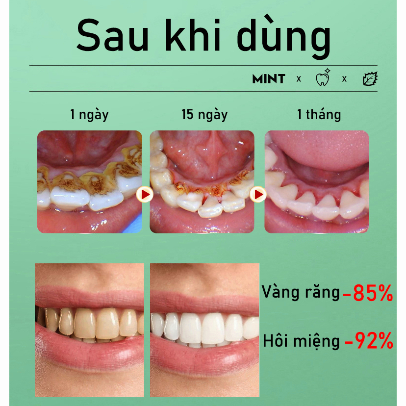 Kem Đánh Răng Làm Trắng Răng loại bỏ cao răng hôi miệng tẩy ố vàng 100g Sửa chữa nướu răng giảm sâu răng