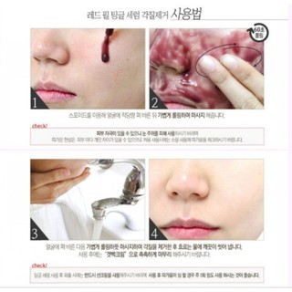Serum Red peel Tingle gói 2,5ml