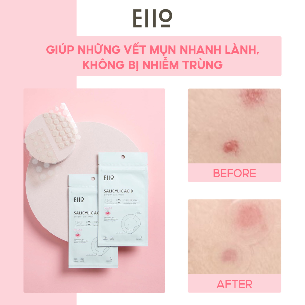 Miếng dán mụn EIIO SPOT CARE PATCH 62EA