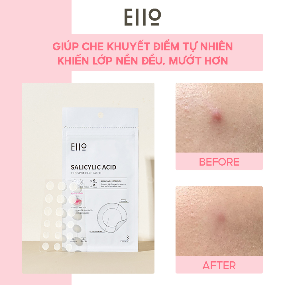 Miếng dán mụn EIIO SPOT CARE PATCH 62EA