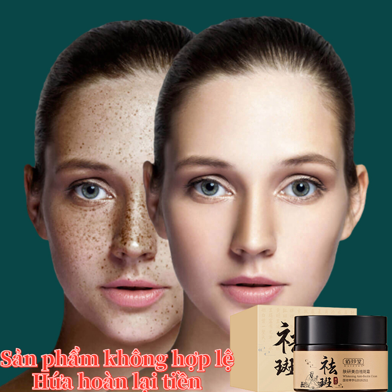 Kem nám tàn nhang Kem trắng da Kem dưỡng ẩm 30g Loại bỏ hiệu quả tàn nhang nám da Dưỡng ẩm Làm sáng màu da