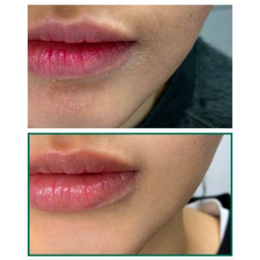 Nước Hoa Hồng Giảm Mụn Some By Mi AHA-BHA-PHA 30 Days Miracle Toner 150ml - Hàng Nhập Khẩu | BigBuy360 - bigbuy360.vn