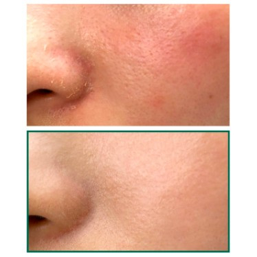 Nước Hoa Hồng Giảm Mụn Some By Mi AHA-BHA-PHA 30 Days Miracle Toner 150ml - Hàng Nhập Khẩu | BigBuy360 - bigbuy360.vn