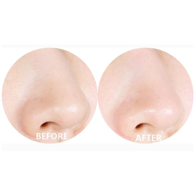 Nước Hoa Hồng Giảm Mụn Some By Mi AHA-BHA-PHA 30 Days Miracle Toner 150ml - Hàng Nhập Khẩu | BigBuy360 - bigbuy360.vn