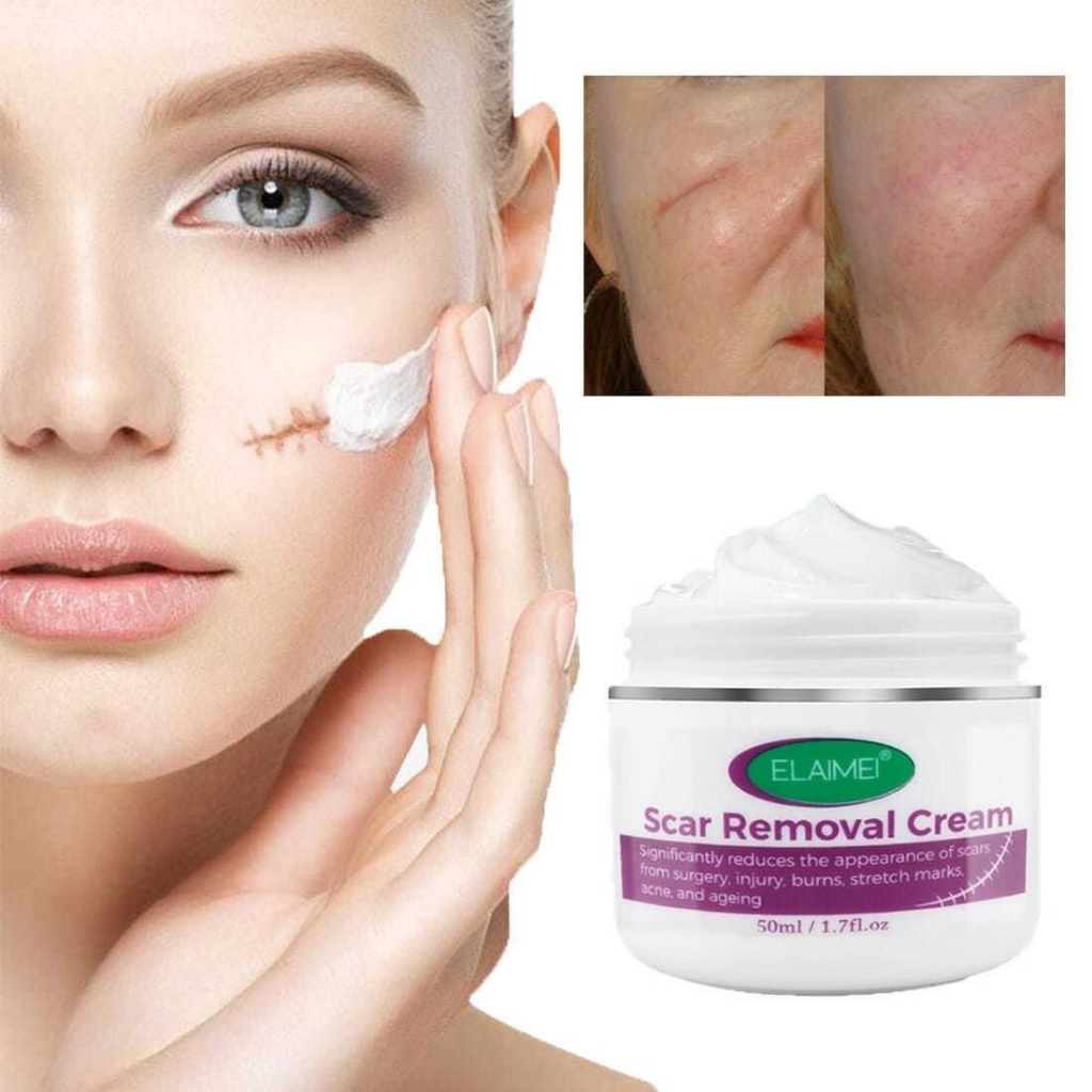 Kem Xoá Mờ Sẹo cho trợ trị sẹo toàn thân - Nhanh mờ sẹo thâm, sẹo lồi, Lõm, rỗ, giảm mụn, rạn da 50ml