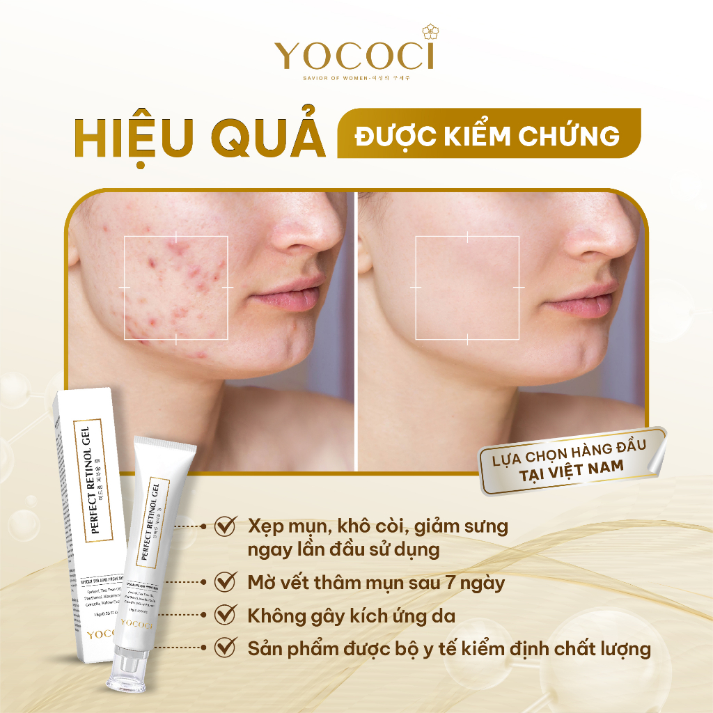 Gel chấm mụn Yococi giảm mụn, xẹp mụn, khô còi, mờ thâm, phục hồi da bị tổn thương Perfect Retinol Gel 15G