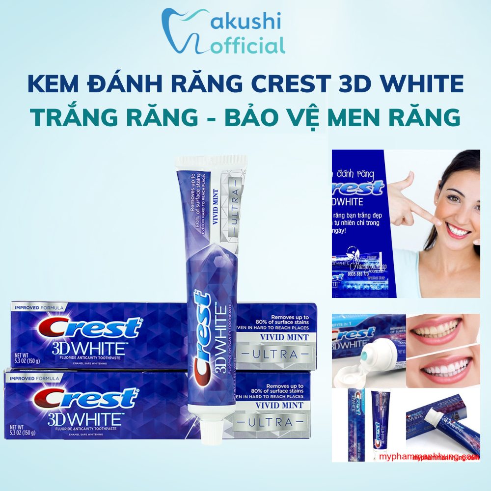 Kem đánh răng CREST 3D WHITE 116G tuýp lớn trắng răng vượt trội hàng nhập