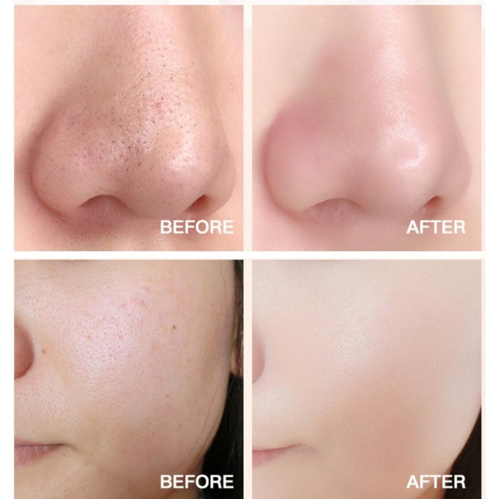 mặt nạ trắng da dưỡng da mặt giảm mụn đắp mặt nạ cà rốt kem mask đào thải độc giảm thâm ngăn ngừa mụn chính hãng giá rẻ | BigBuy360 - bigbuy360.vn